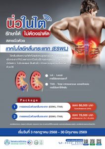 สลายนิ่วด้วยเทคโนโลยีคลื่นกระแทก (ESWL)