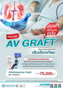 เส้นฟอกเลือดล้างไตชนิดเส้นเลือดเทียม AV GRAFT