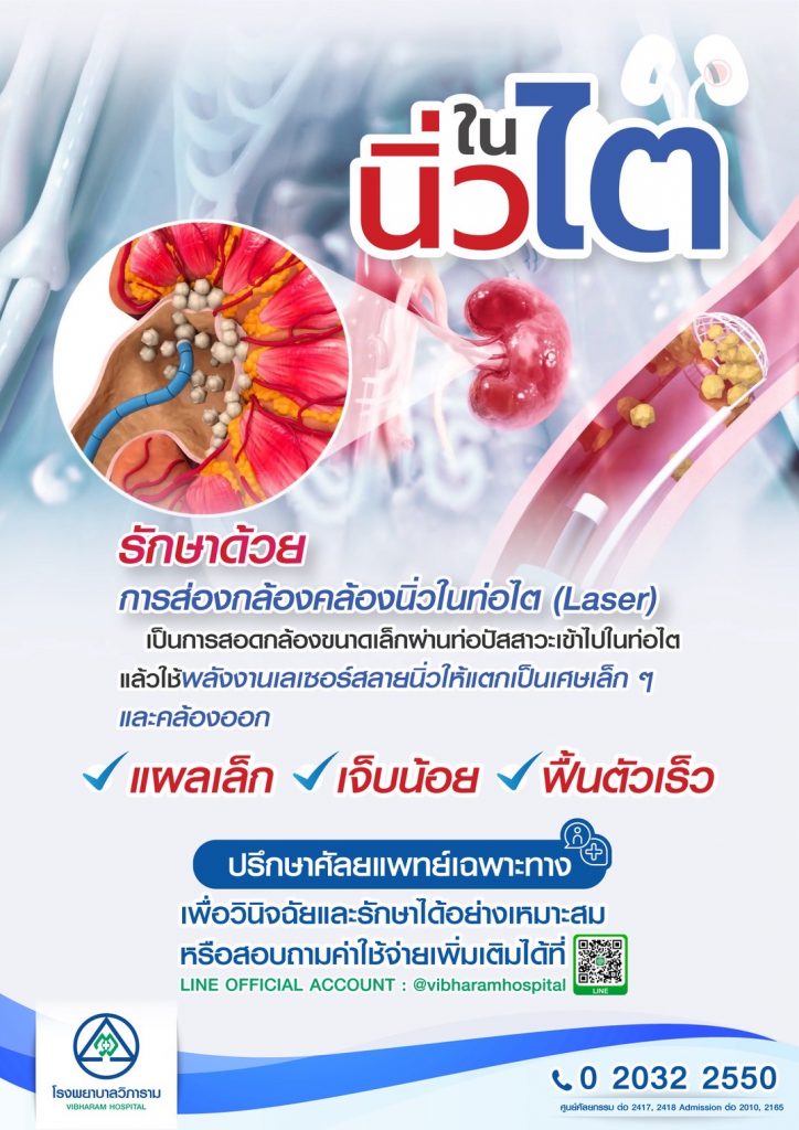 สลายนิ่วในท่อไตด้วยการส่องกล้องโดยการ LASER