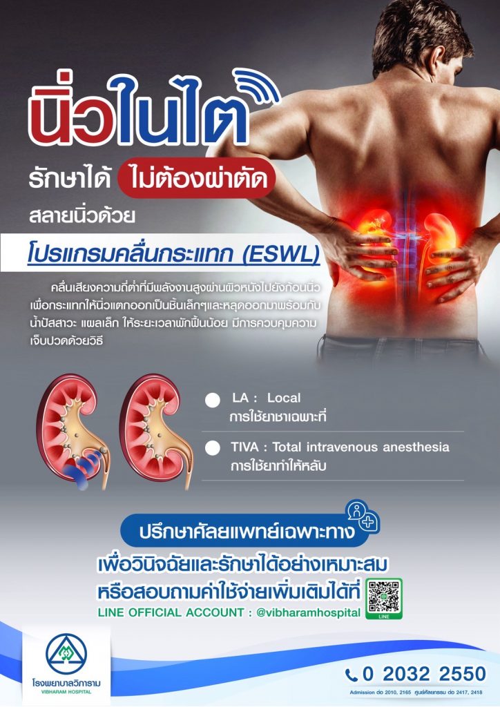 สลายนิ่วด้วยเทคโนโลยีคลื่นกระแทก (ESWL)