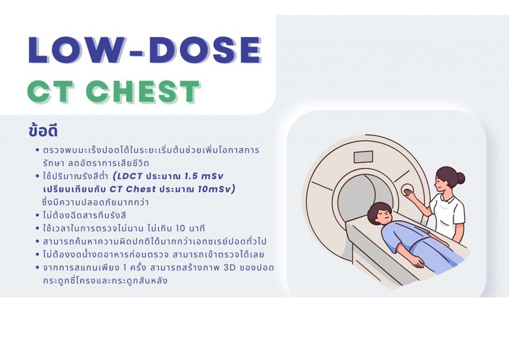 ตรวจคัดกรองมะเร็งปอด Low-Dose CT Chest