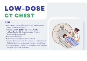 ตรวจคัดกรองมะเร็งปอด Low-Dose CT Chest