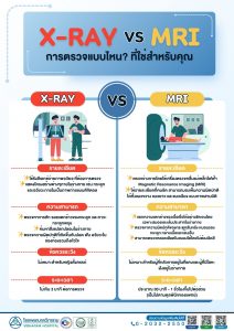 X-Ray VS MRI การตรวจแบบไหนที่ใช่สำหรับคุณ